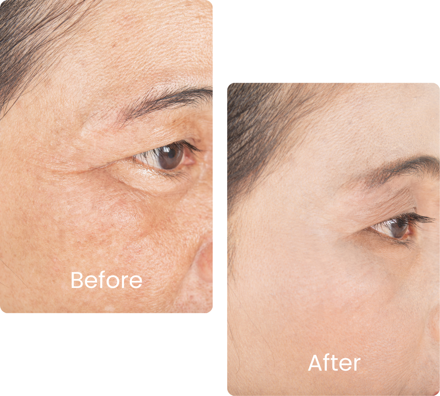 GHK-CU 50mg Advance skincare collagen beauty support.