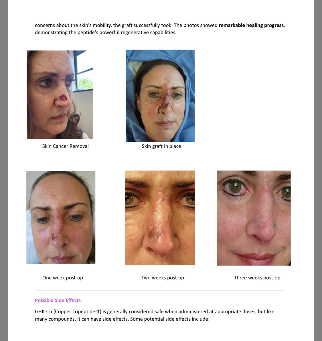 GHK-CU 50mg Advance skincare collagen beauty support.