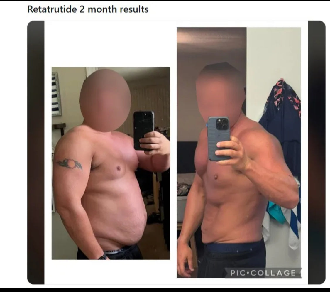 Ripped with Ret10